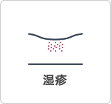 湿疹