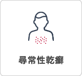 尋常性乾癬