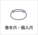巻き爪・陥入爪