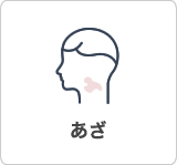 あざ